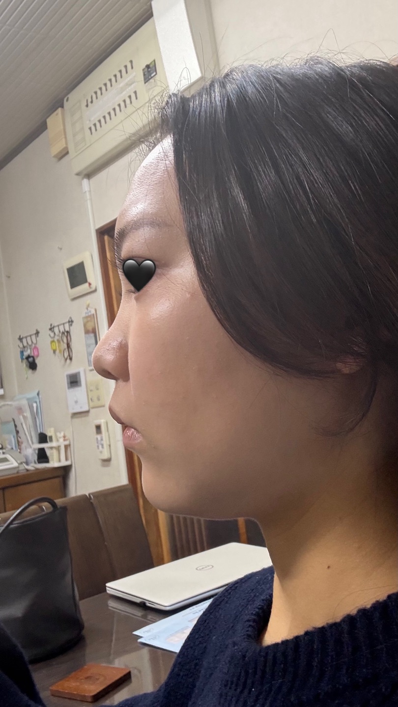 脂肪溶解注射の施術・口コミ・クリニック情報(2025) | カンナムオンニ