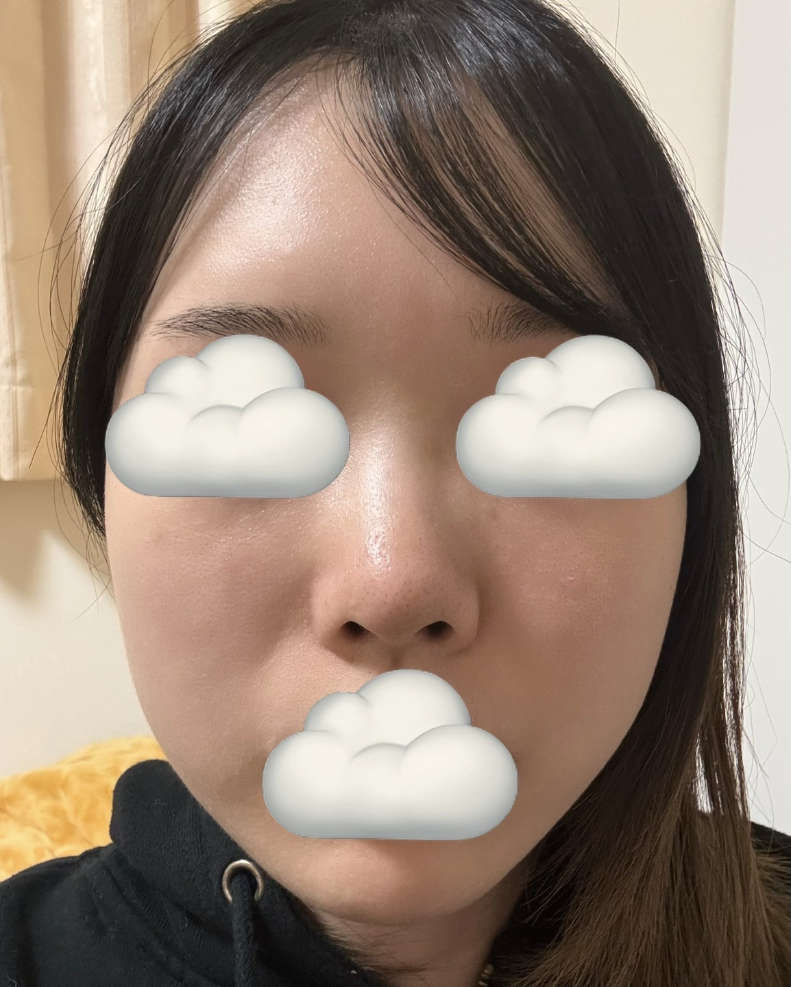 ジョン べ ネ 整形