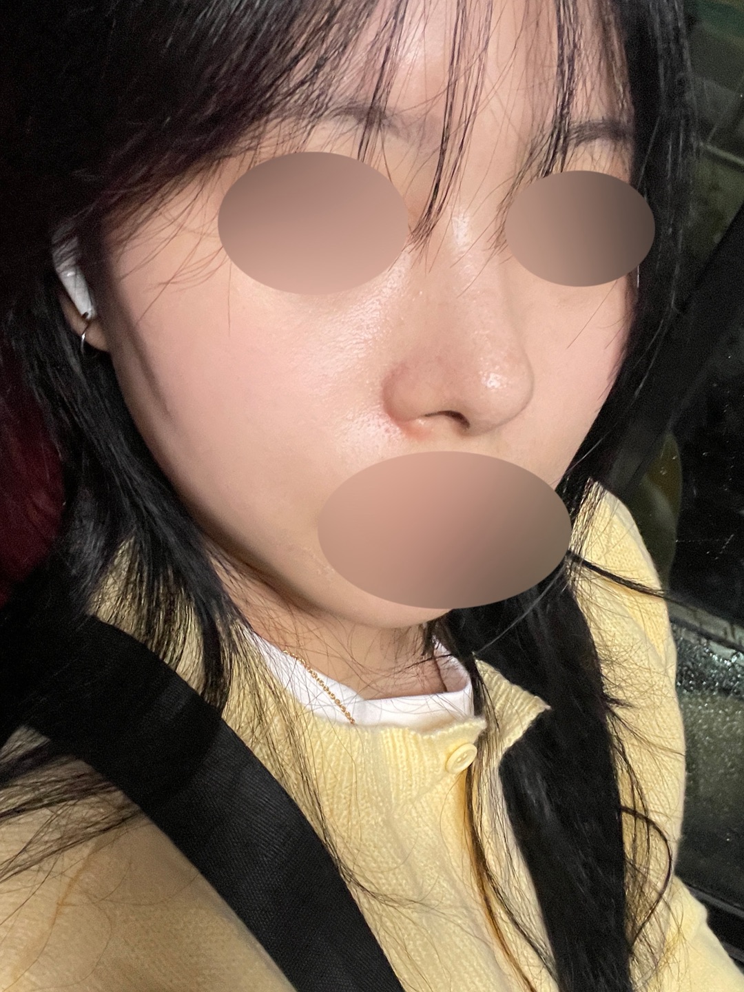 フリートーク: ミホ整形外科のユン·... | カンナムオンニ｜国内利用者数No.1美容医療・整形の口コミ予約アプリ, image size:1080x1440