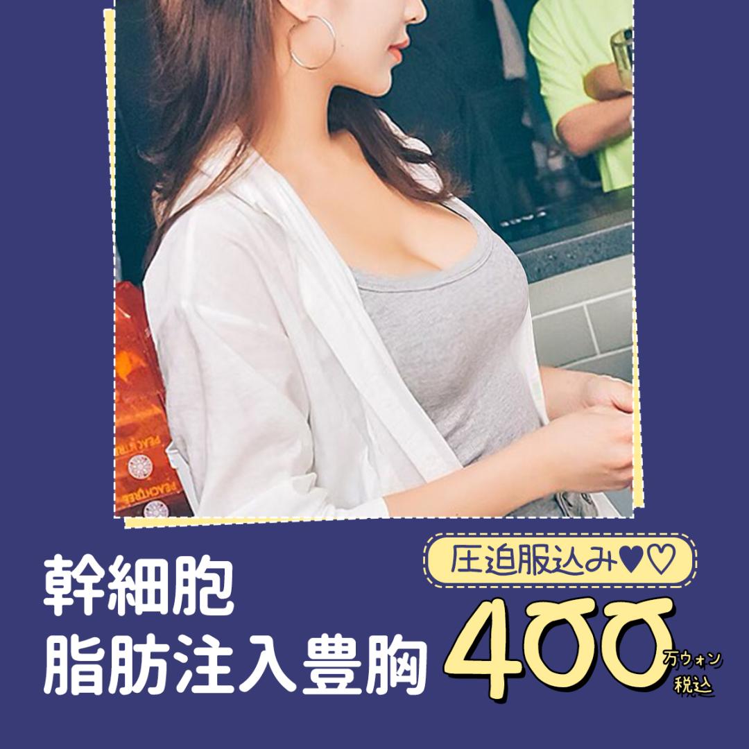 幹細胞脂肪注入豊胸
