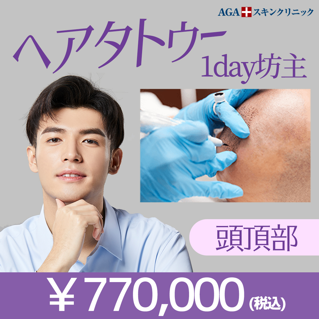 ヘアタトゥー 1day坊主 頭頂部 カンナムオンニ ヘアタトゥー 1day坊主 頭頂部 カンナムオンニ