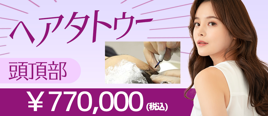 ヘアタトゥー 頭頂部