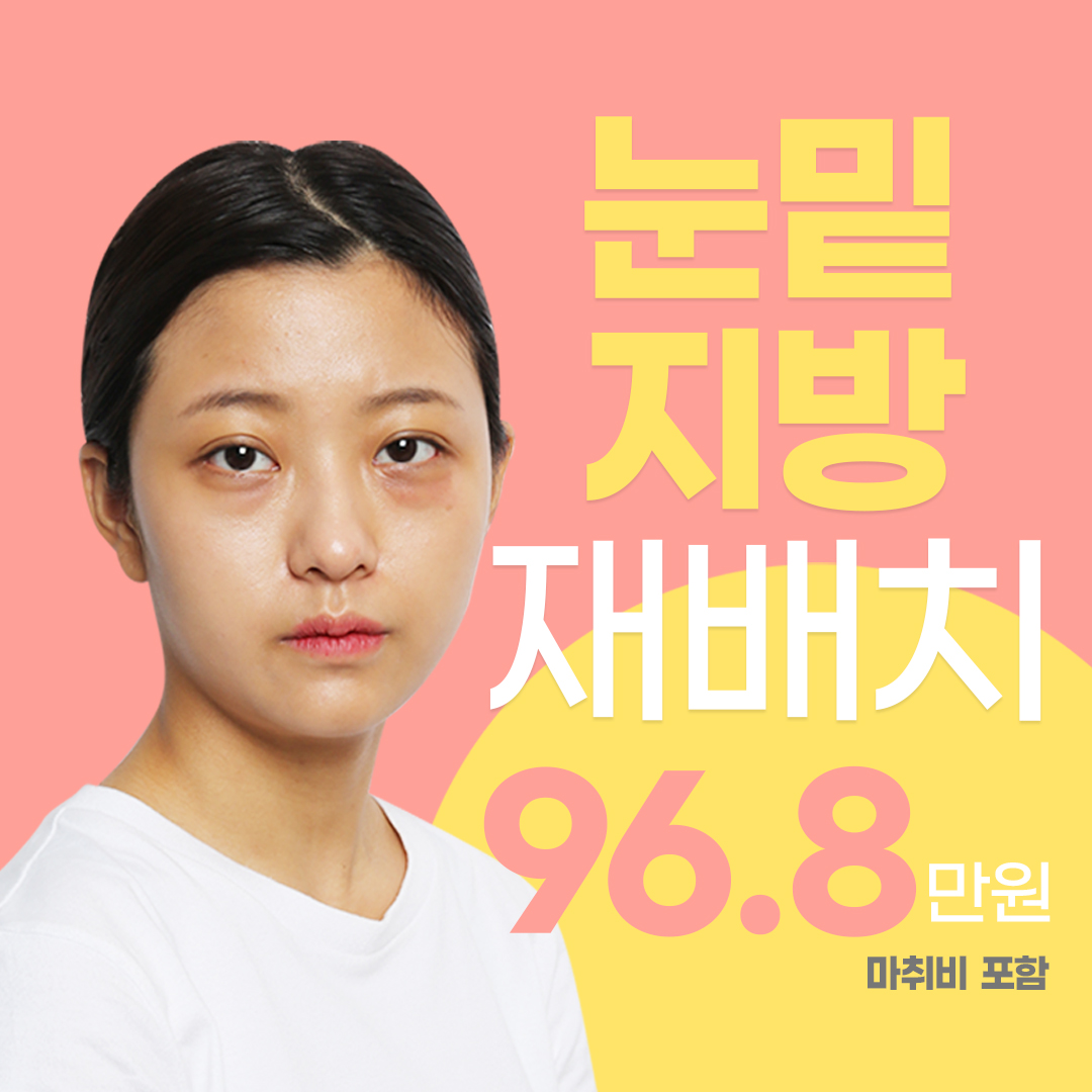 바노바기 눈밑지방재배치