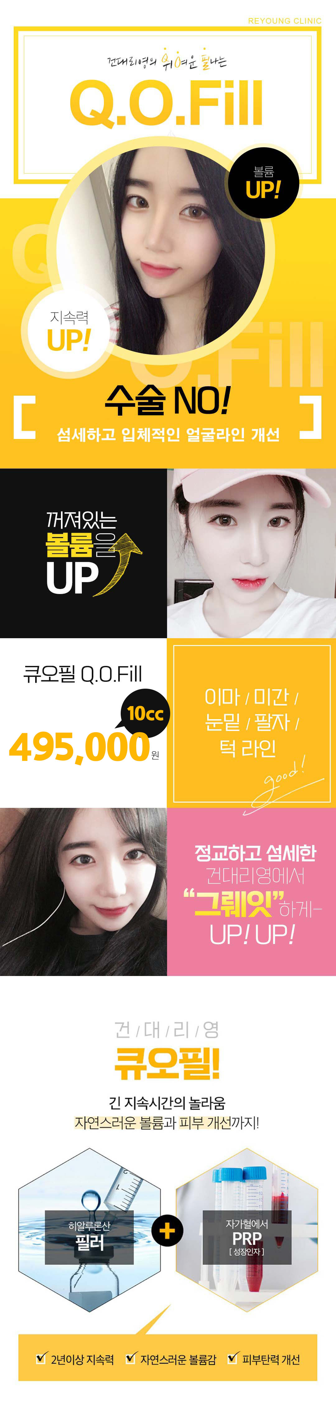 필러 보톡스 성형 교육병원 건대리영의 파격적인 이벤트