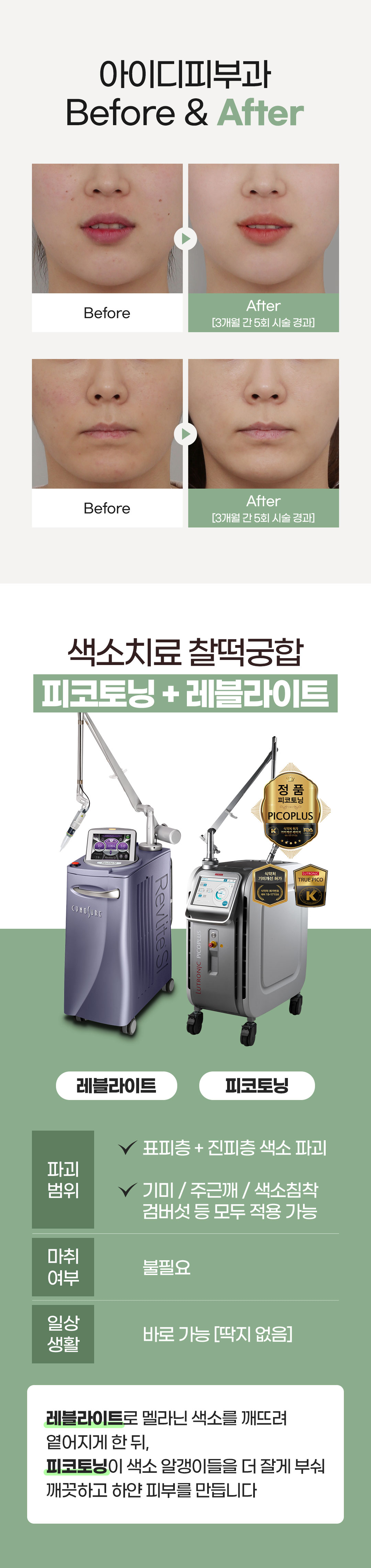 잡티 없이 깨끗하게, 맞춤 색소 치료