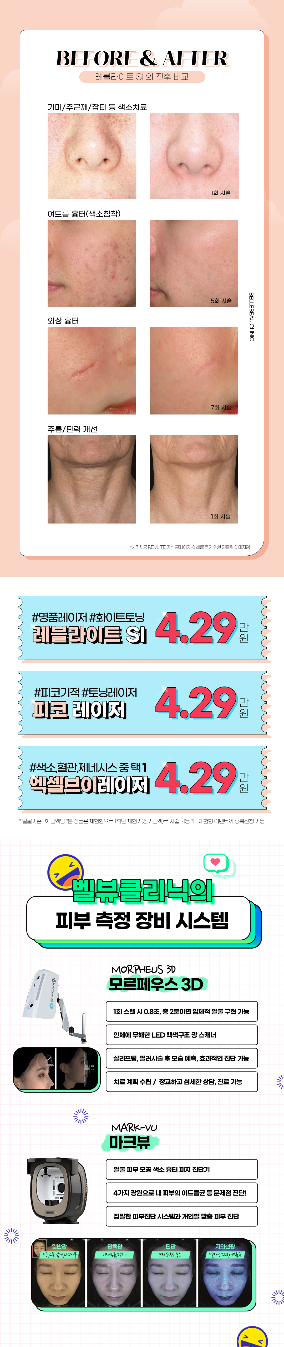 레블라이트, 엑셀브이시술, 피코토닝 체험이벤트