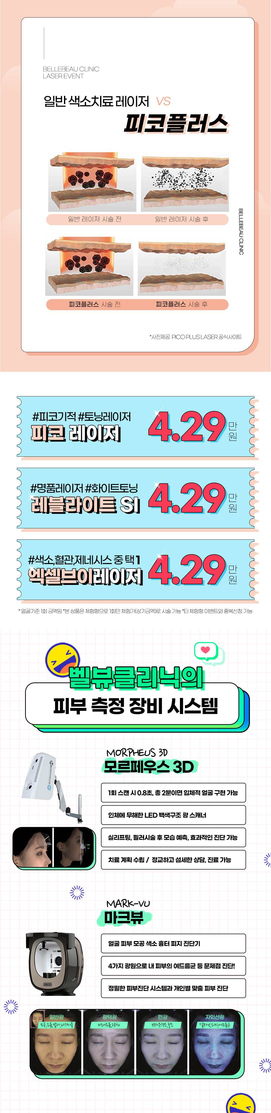 피코레이저, 엑셀브이, 레블라이트 체험이벤트