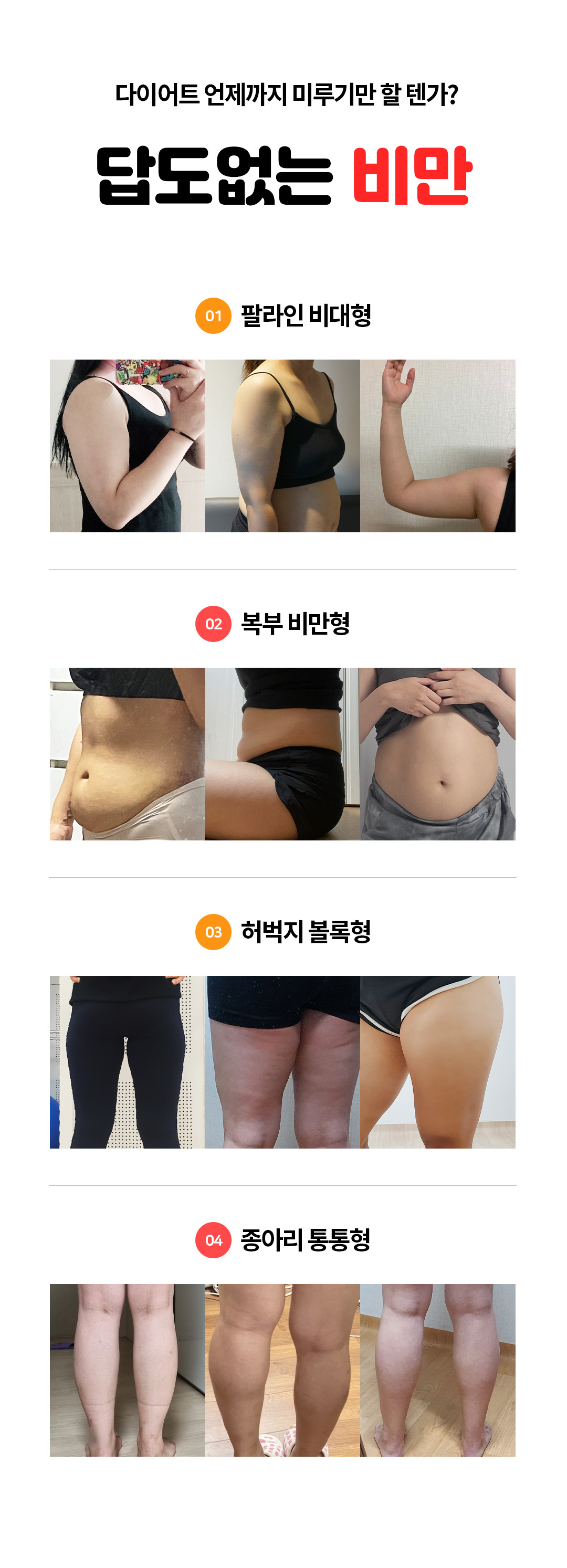 MPL핏 이제는 원하는 라인 어디든 대용량으로 시술받자