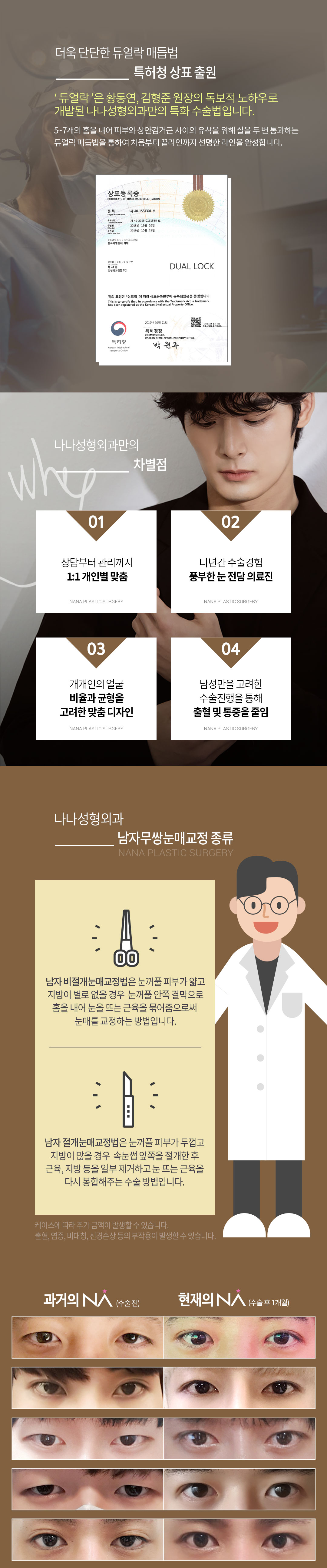 또렷한 남자무쌍눈매교정, 990000KRW, Seoul Gangnam-gu 신논현역, 나나성형외과의원