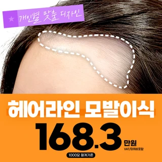 자연스러운_여자 헤어라인 모발이식_절개1000모