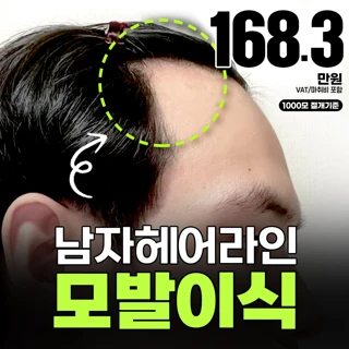 아이돌 헤어라인 모발이식