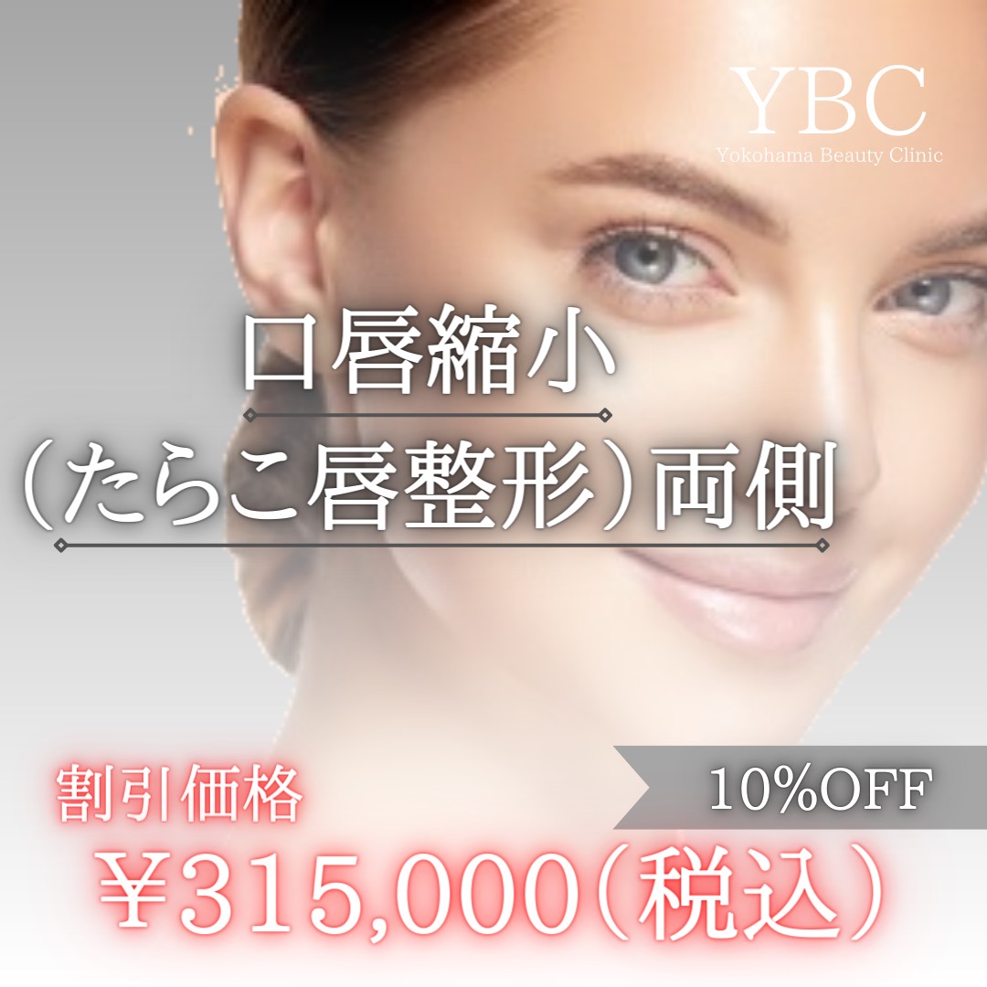 たらこ唇様確認用 💁🏻‍♀️口唇縮小術 お写真直前・1ヶ月後になります🌟 〈口唇