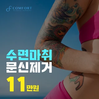 편안한 문신제거