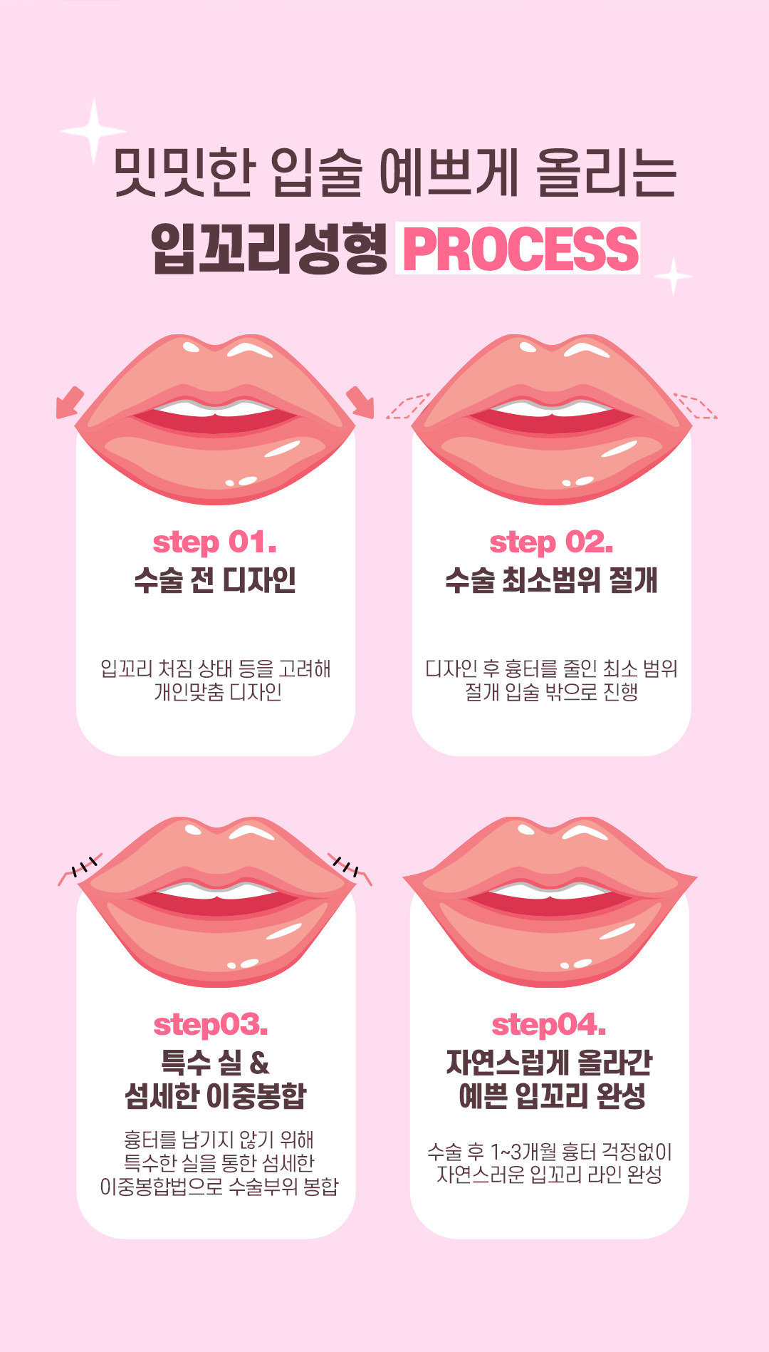 디에이 입꼬리 성형 by 디에이성형외과의원 | 강남언니 - 1등 성형수술&피부시술 정보앱
