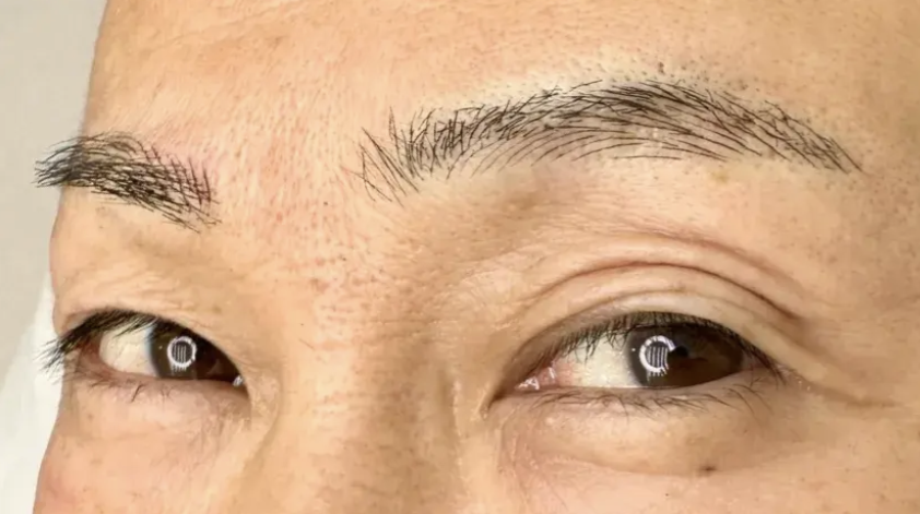 マイクロブレードはどれくらい持続しますか?