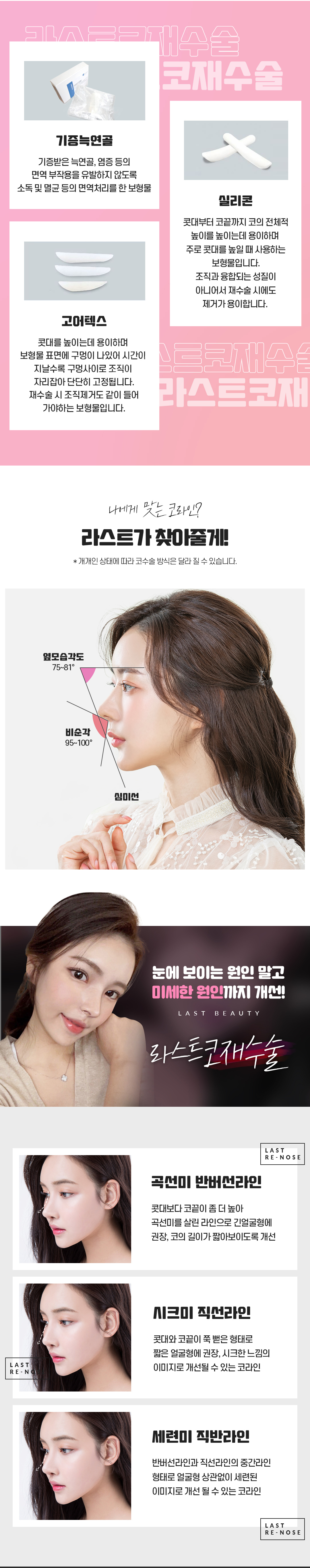라인재교정, 구축코, 염증코, 코재수술