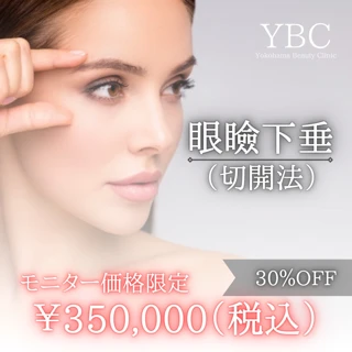 【モニター】眼瞼下垂(切開法)