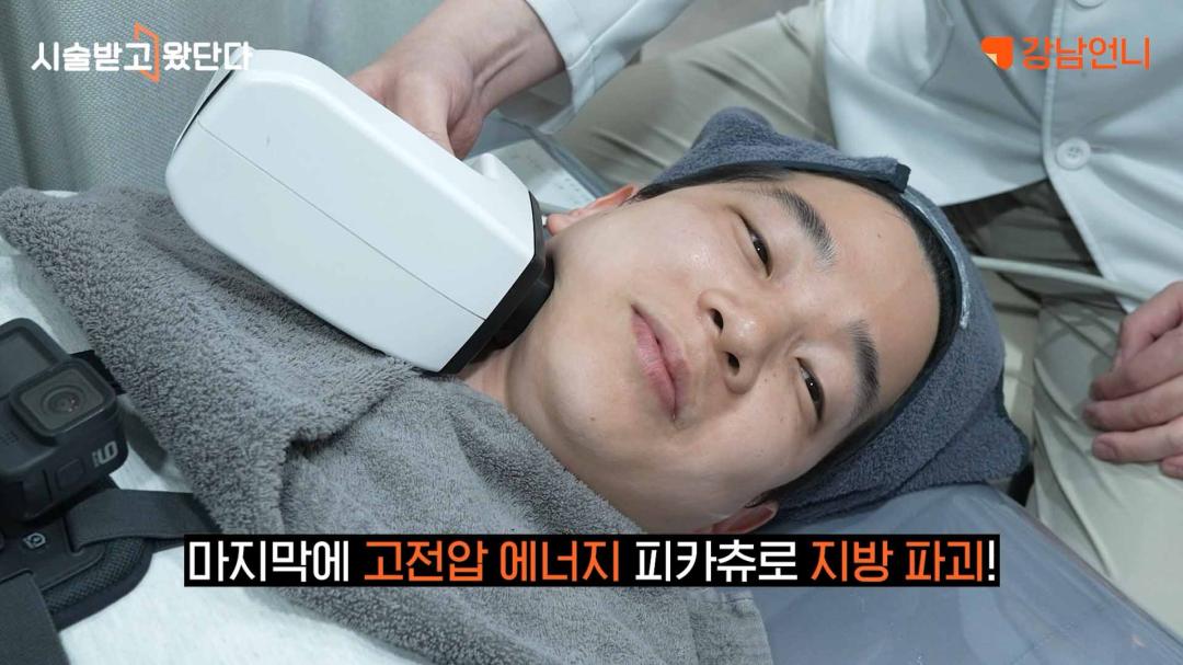 인모드 고전압 프로세스 팔자주름 효과.jpg