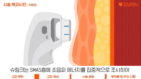 02_슈링크 원리 인모드와 차이점.gif