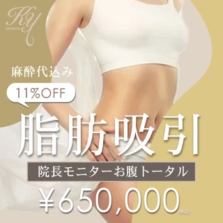 【院長モニター】お腹トータル脂肪吸引