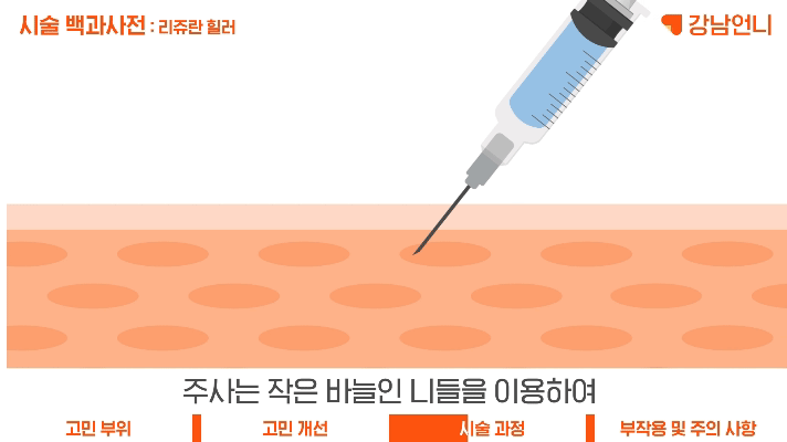 리쥬란힐러 후기 통해 엠보 얼마나 가는지, 효과 BEST 주기 알아봐요! | 강남언니 - 1등 성형수술&피부시술 정보앱