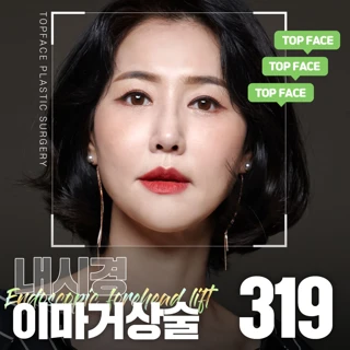 탑페이스 내시경 이마거상술
