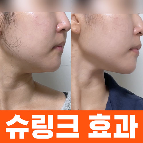 슈링크 썸네일.jpg