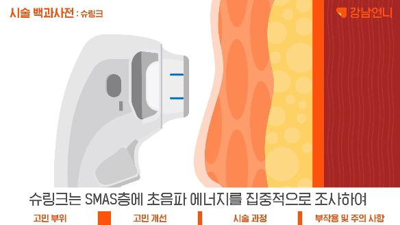 슈링크 효과 원리.gif