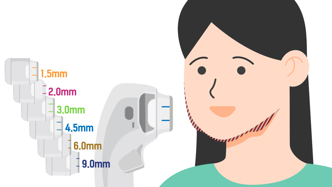 슈링크 효과 좋은 이유.jpg