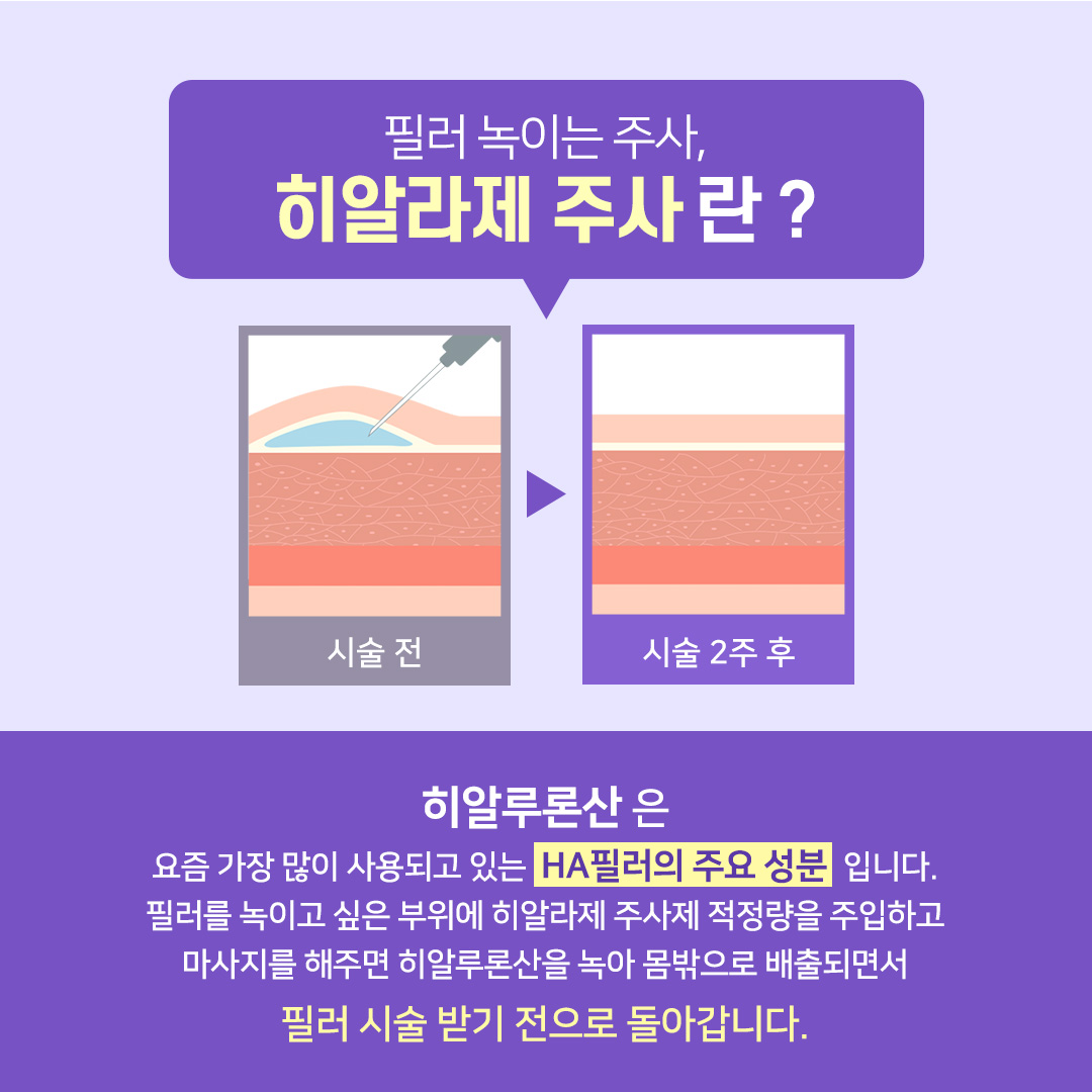 필러가 뭉치거나 녹이고 싶은 부위에 적정량을 주입
마사지를 해주면 필러의 주요성분인 히알루론산이 녹아 일주일 내에 몸밖으로 배출
피부손상과 부작용이 거의 없이 맞춤형 필러 제거를 통해 고민을 빠르게 해결