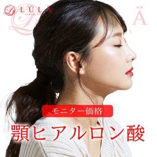  【モニター】顎ヒアルロン酸