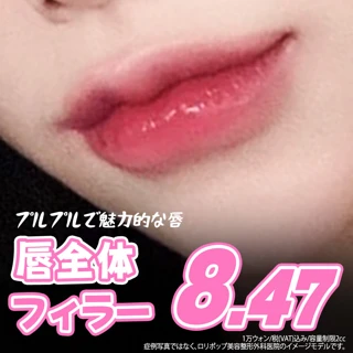 ロリポップ　唇フィラー