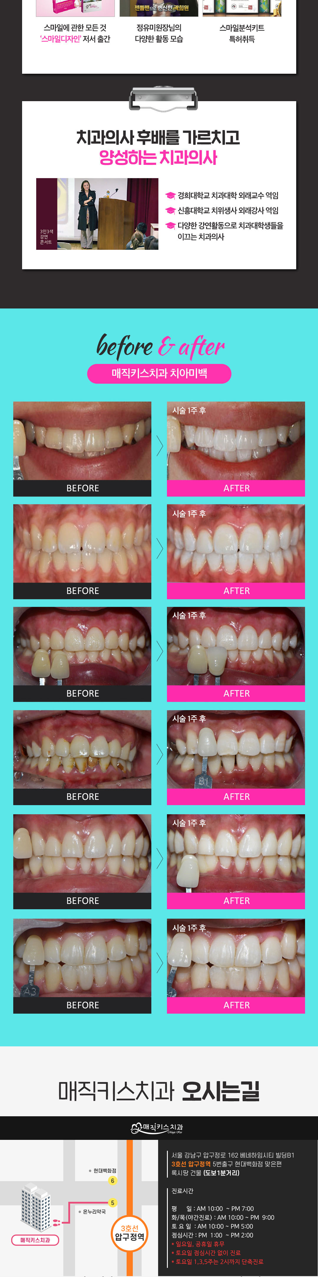소개팅 필수 준비 원데이 미백,