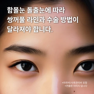 대구 리프트 디자인 쌍꺼풀 눈성형