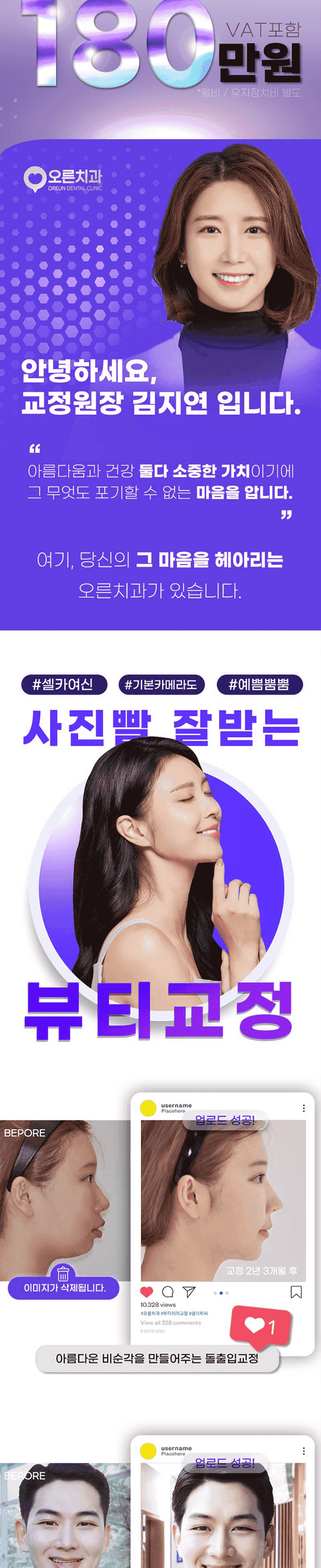 클리피씨 전체교정 치아교정