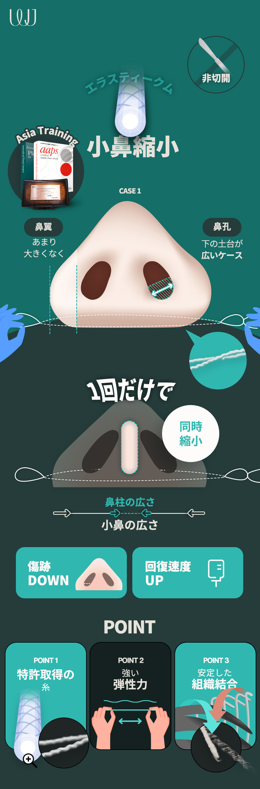 WONJIN 非切開小鼻縮小 | WJウォンジン美容外科医院