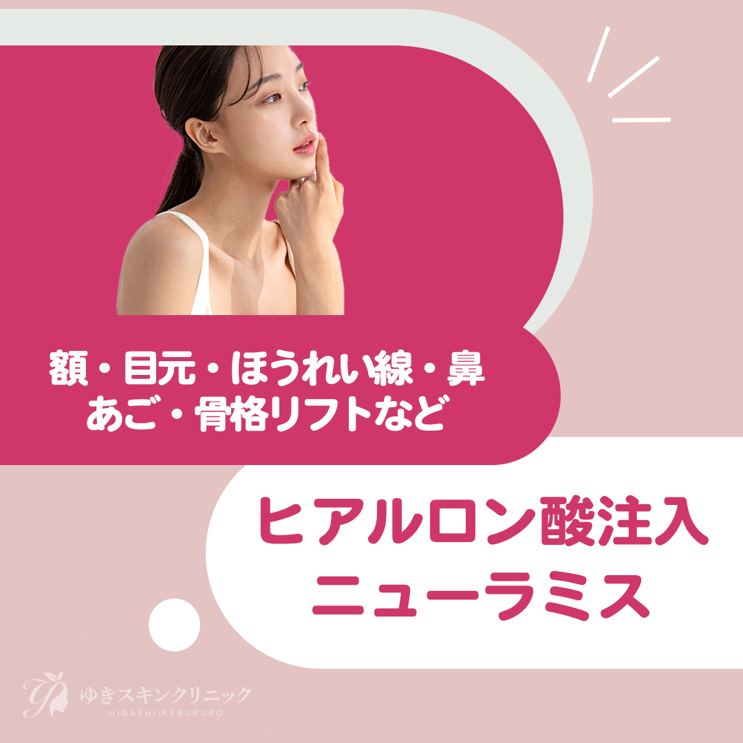 ニューラミス VOLUME ヒアルロン酸 1ml×1本