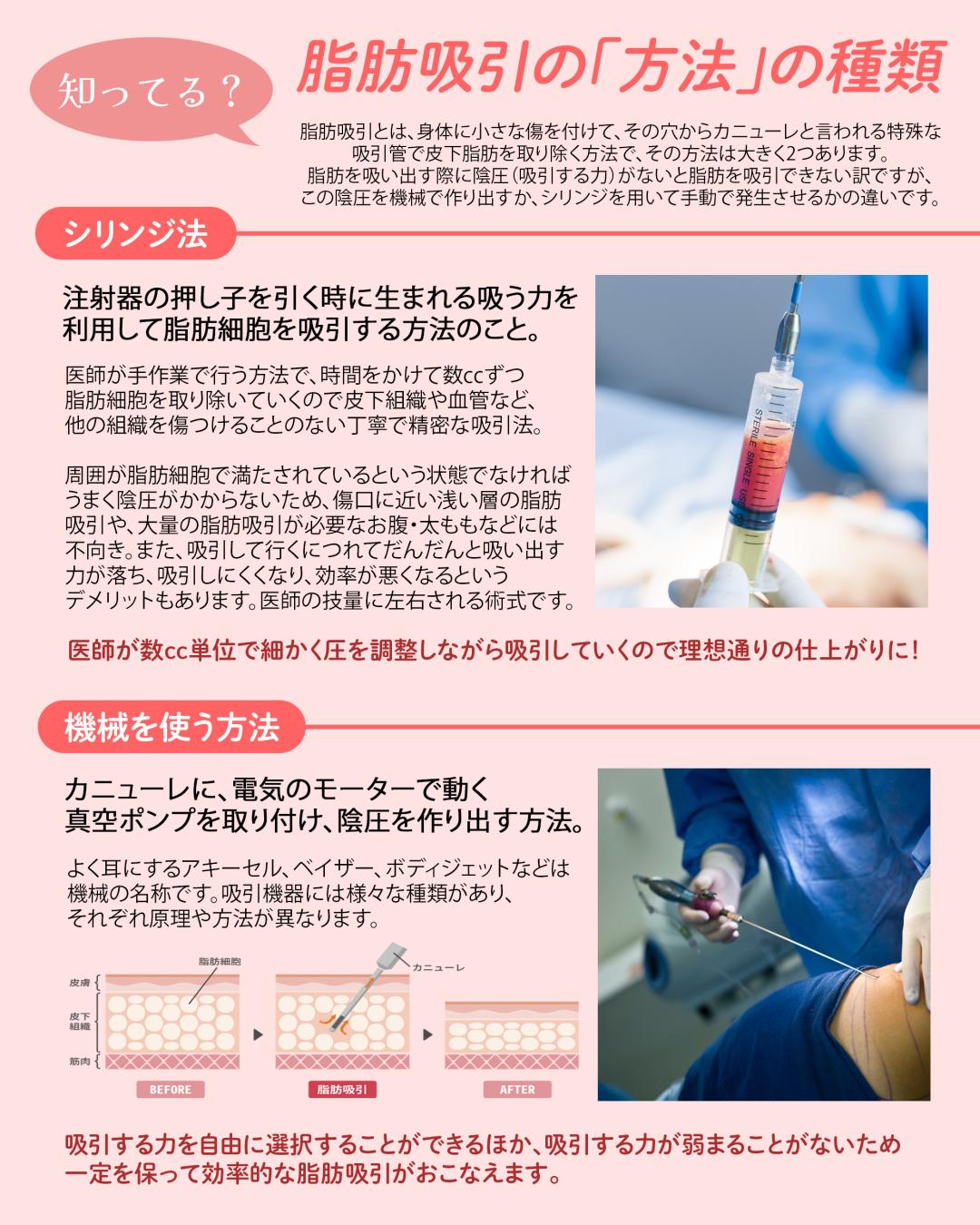 【モニター】脂肪吸引｜太もも全周+膝上+臀部セット
■料金：¥1,760,000→¥990,000(税込)43%OFF
■対象部位：大腿(内側、前面、外側)+膝上+臀部

〈別途かかる費用〉
■初診料：無料
■再診料：無料
■カウンセリング料：無料
■麻酔代：各麻酔で以下料金がかかります。
・笑気麻酔：¥5,500(税込)
・静脈麻酔：¥55,000(税込)
■圧迫サポーター：¥16,500(税込)
■アフターケア代：無料
※薬代込み

《脂肪吸引》
麻酔をかけた上で、吸引管を挿入し、皮下脂肪を吸引することで、臀部から膝上までのボリュームを減らしていく施術です。
また、脂肪細胞の数自体を確実に減らすことができる為、「脂肪溶解注射」よりも高い効果が期待でき、部分痩せの効果を期待することができます。
その他、部分瘦せの効果は一生モノとなっており、仮に少し太ってしまった場合でも、吸引した部分の脂肪がつきにくいメリットがございますので、リバウンドの心配が強い方にもおすすめの施術となっております。
※基本的に成人以降の脂肪細胞の数に変化はありませんが、極度に太ってしまった場合は脂肪細胞が分裂・増加するリスクがございます。

【モニターの注意事項】
・施術前と施術後に一定回数の写真撮影が可能な方のみとさせていただきます。
・施術後も一定回数クリニックに通院いただける方のみとさせていただきます。

【予約に関しての注意事項】
・武内院長のオペ(注入以外)と2週間以上先カウンセリングのご予約は事前の予約金が必要になりますので、予めご了承ください。