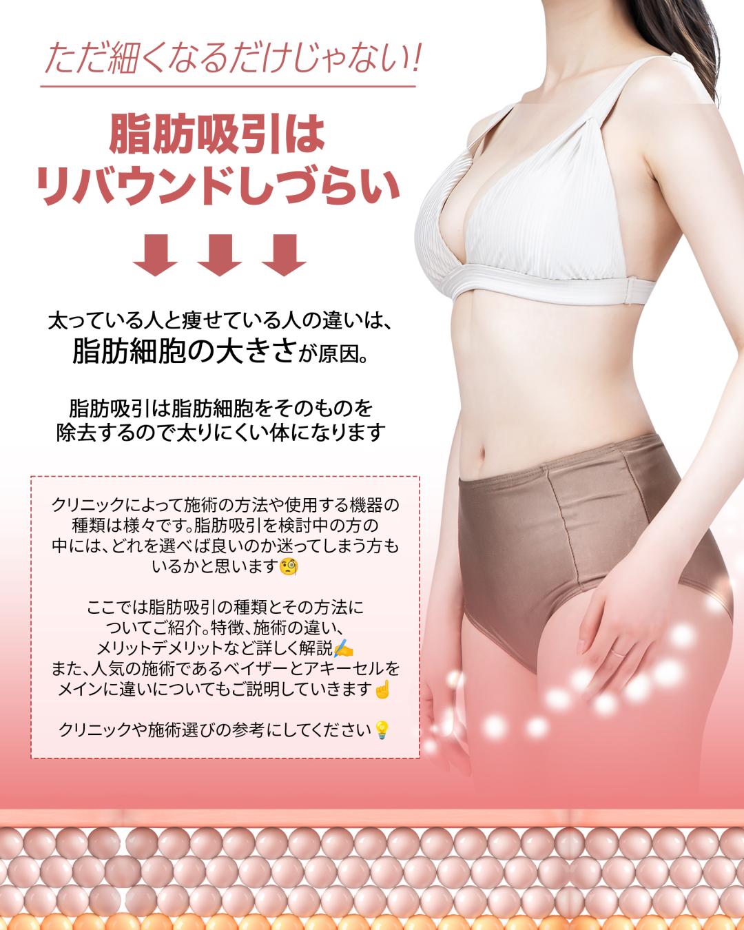 【モニター】脂肪吸引|膝上
■料金:¥330,000→¥220,000(税込)33%OFF
■対象部位:膝上
〈別途かかる費用〉
■初診料:無料
■再診料:無料
■カウンセリング料:無料
■麻酔代:各麻酔で以下料金がかかります。
・笑気麻酔:¥5,500(税込)
・静脈麻酔:¥55,000(税込)
■圧迫サポーター:¥16,500(税込)
■アフターケア代:無料
※薬代込み
《脂肪吸引》
麻酔をかけた上で、吸引管を挿入し、皮下脂肪を吸引することで、膝上のボリュームを減らしていく施術です。
また、脂肪細胞の数自体を確実に減らすことができる為、「脂肪溶解注射」よりも高い効果が期待でき、部分痩せの効果を期待することができます。
その他、部分瘦せの効果は一生モノとなっており、仮に少し太ってしまった場合でも、吸引した部分の脂肪がつきにくいメリットがございますので、リバウンドの心配が強い方にもおすすめの施術となっております。
※基本的に成人以降の脂肪細胞の数に変化はありませんが、極度に太ってしまった場合は脂肪細胞が分裂・増加するリスクがございます。
【モニターの注意事項】
・施術前と施術後に一定回数の写真撮影が可能な方のみとさせていただきます。
・施術後も一定回数クリニックに通院いただける方のみとさせていただきます。
【予約に関しての注意事項】
・武内院長のオペ(注入以外)と2週間以上先カウンセリングのご予約は事前の予約金が必要になりますので、予めご了承ください。
