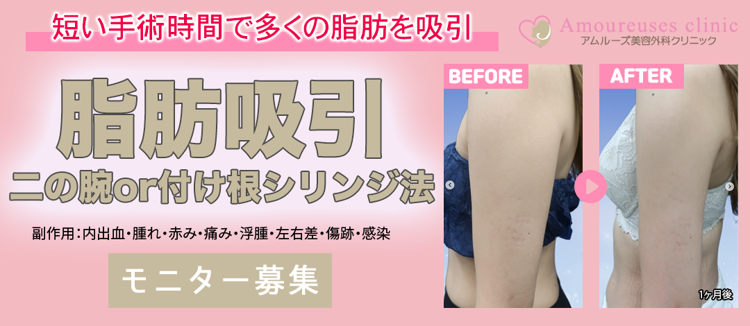 セルリダクション〈脂肪細胞縮小／筋肉細胞調整〉（２本セット） 脂肪吸引/豊胸】東京シンデレラ美容外科 吉原伯 | 【担当医