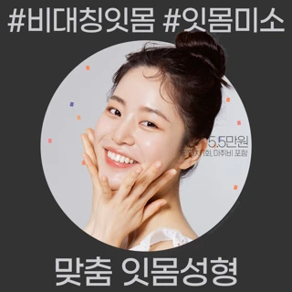 잇몸미소 거미스마일 잇몸성형