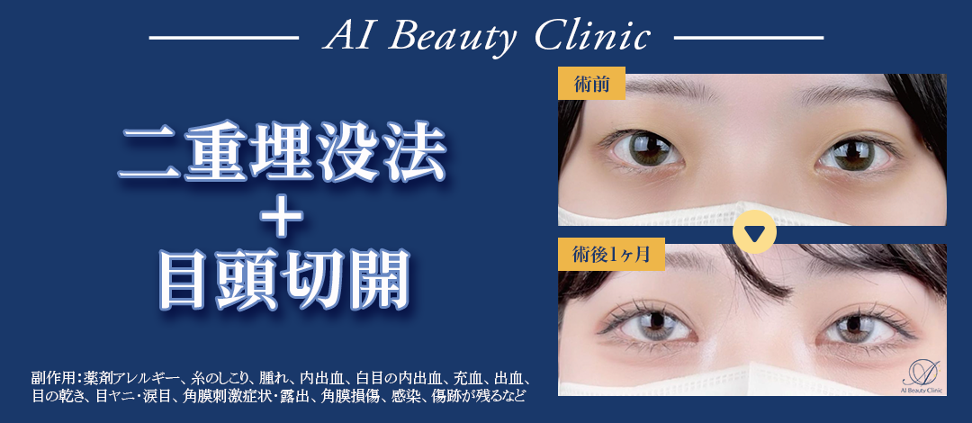 二重埋没＋目頭切開セット | AI Beauty Clinic（エーアイ美容