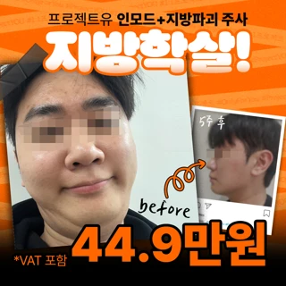 시그니처_지방파괴 패키지 &인모드fx,foma 시술시간보장 지방파괴주사 지방분해주사 윤곽주사 이중턱주사 맞춤디자인 리니어지&
