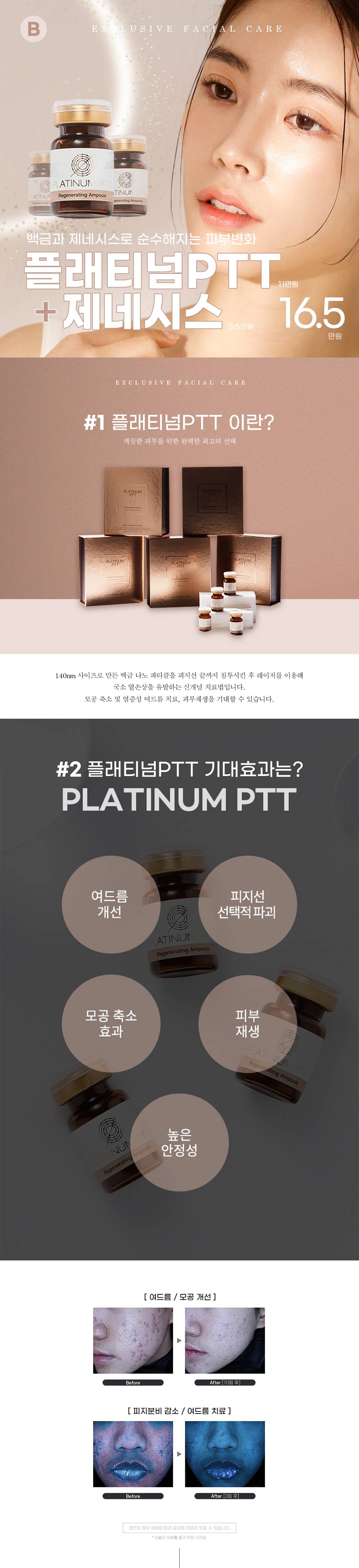 여드름개선, 모공관리, 피부재생까지