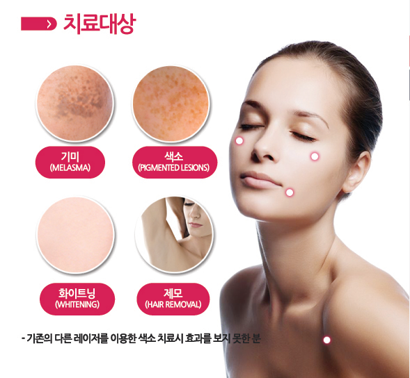 빠르고 통증적은 노블린 레이저로 반영구 제모를 합니다. 
연고마취비용이 포함되어 있습니다. 
시술을 반복할수록 털이 점점 줄어듭니다. 