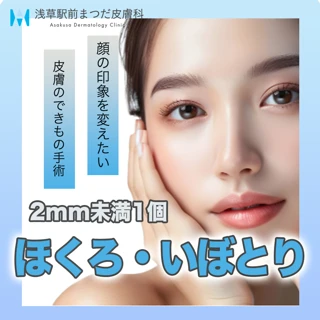 ほくろ・いぼとり手術|2mm未満(1個)
