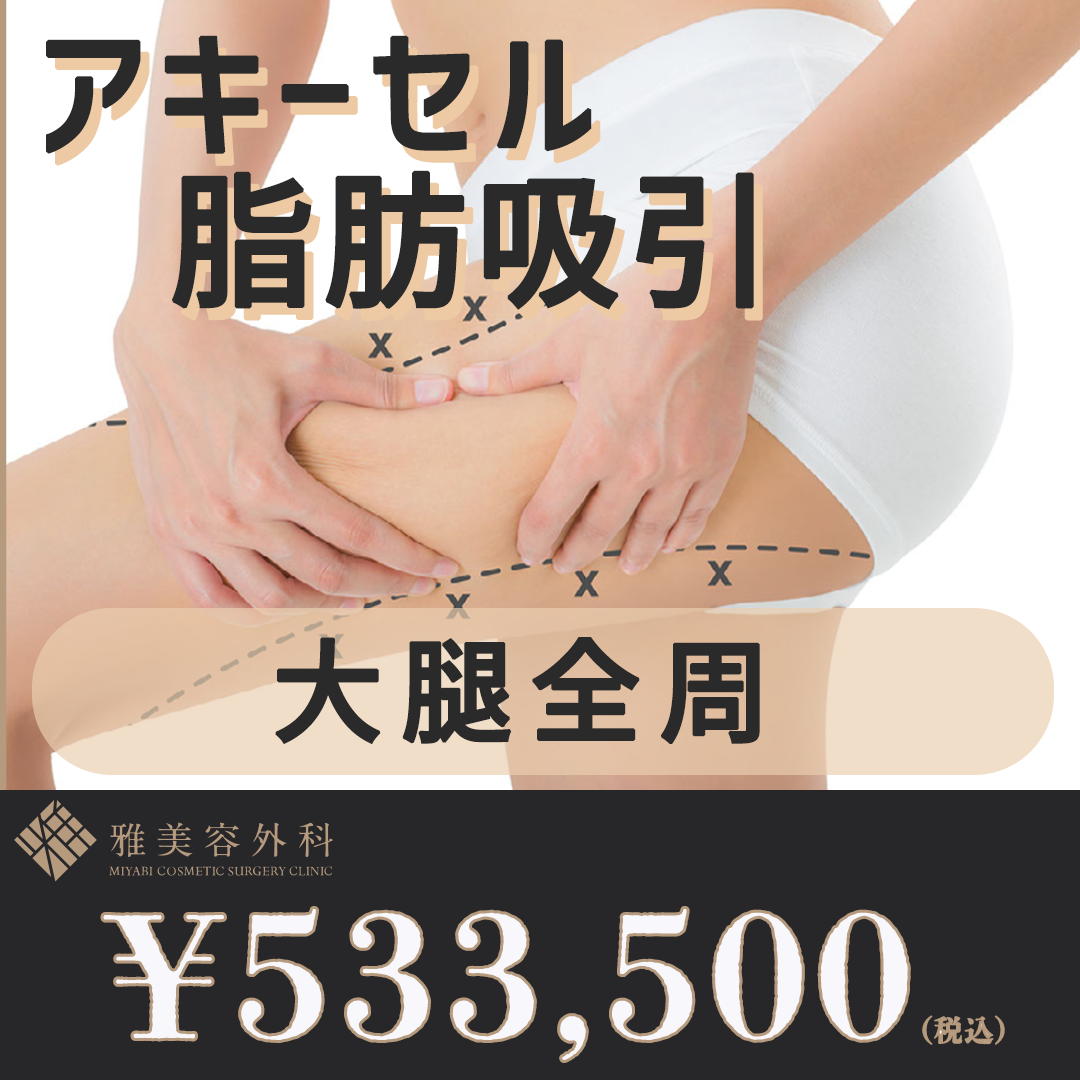 脂肪吸引器 川端 久雅 院長執刀】大腿全周 アキーセル脂肪吸引 脂肪吸引総症例数