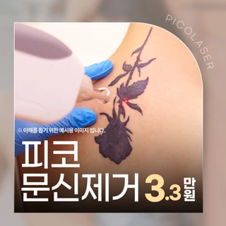 타투 지우는 피코문신제거