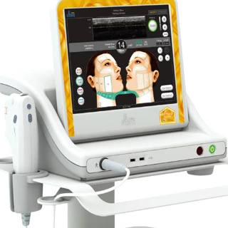 Ulthera face lifting with sedative anesthesia 