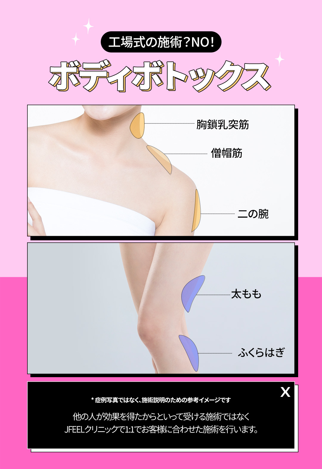 ボトックスで過度に発達した筋肉を整えて
スリムなラインだけを残そう

－純正・定量のみを施術し、過度な施術は×
－個人の骨格、筋肉量に合わせた施術で効果と満足度UP